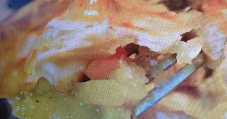 Foto da receita de Torta de Frango com Curry de Coco
